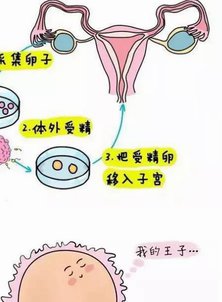 北京试管婴儿查体注意事项，确保健康，顺利好孕